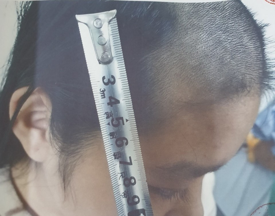 Khởi tố ông bố nghiện ngập, đánh đập, cắt nham nhở tóc con gái tại Bắc Ninh ảnh 1