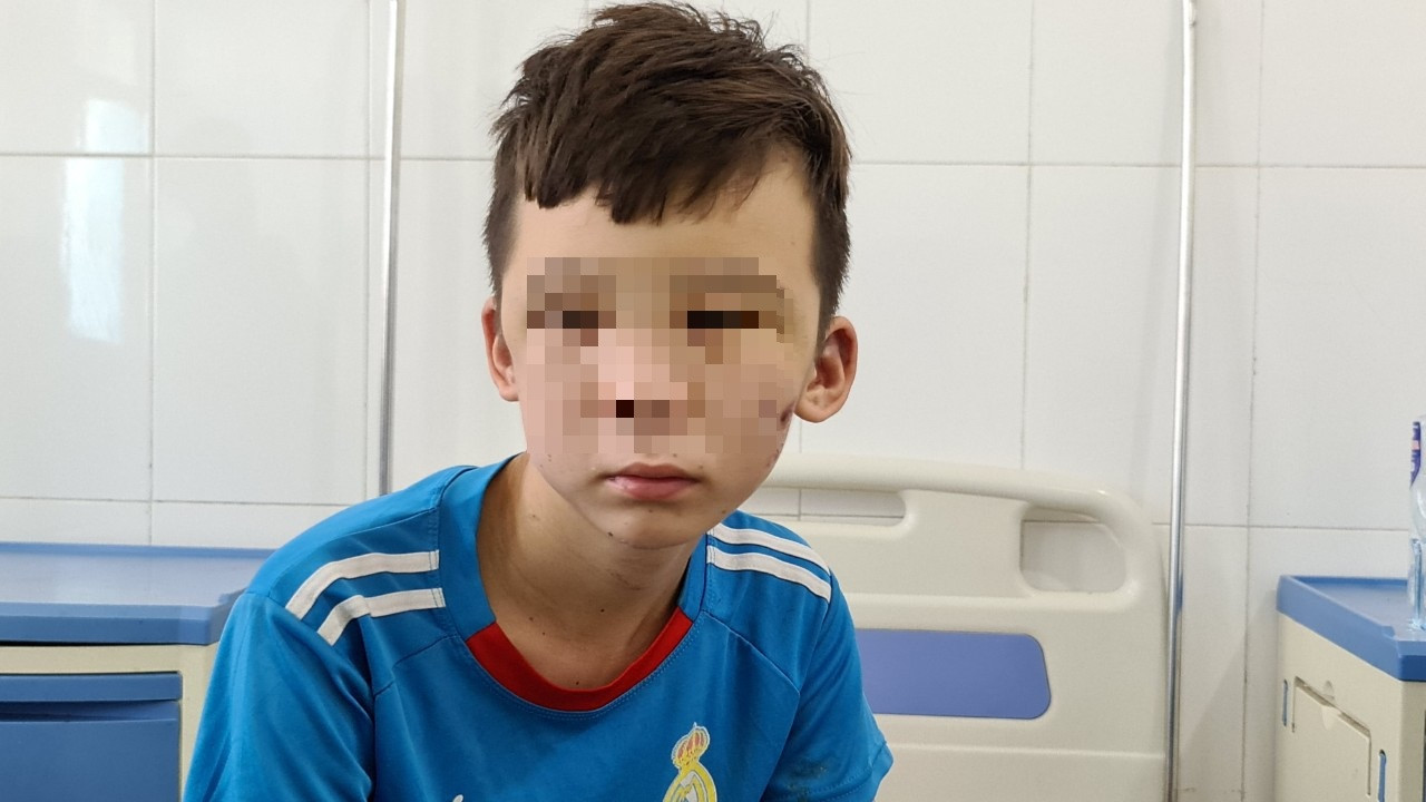 Tạm giữ chủ quán bánh xèo hành hạ bé trai làm thuê tại Bắc Ninh ảnh 2