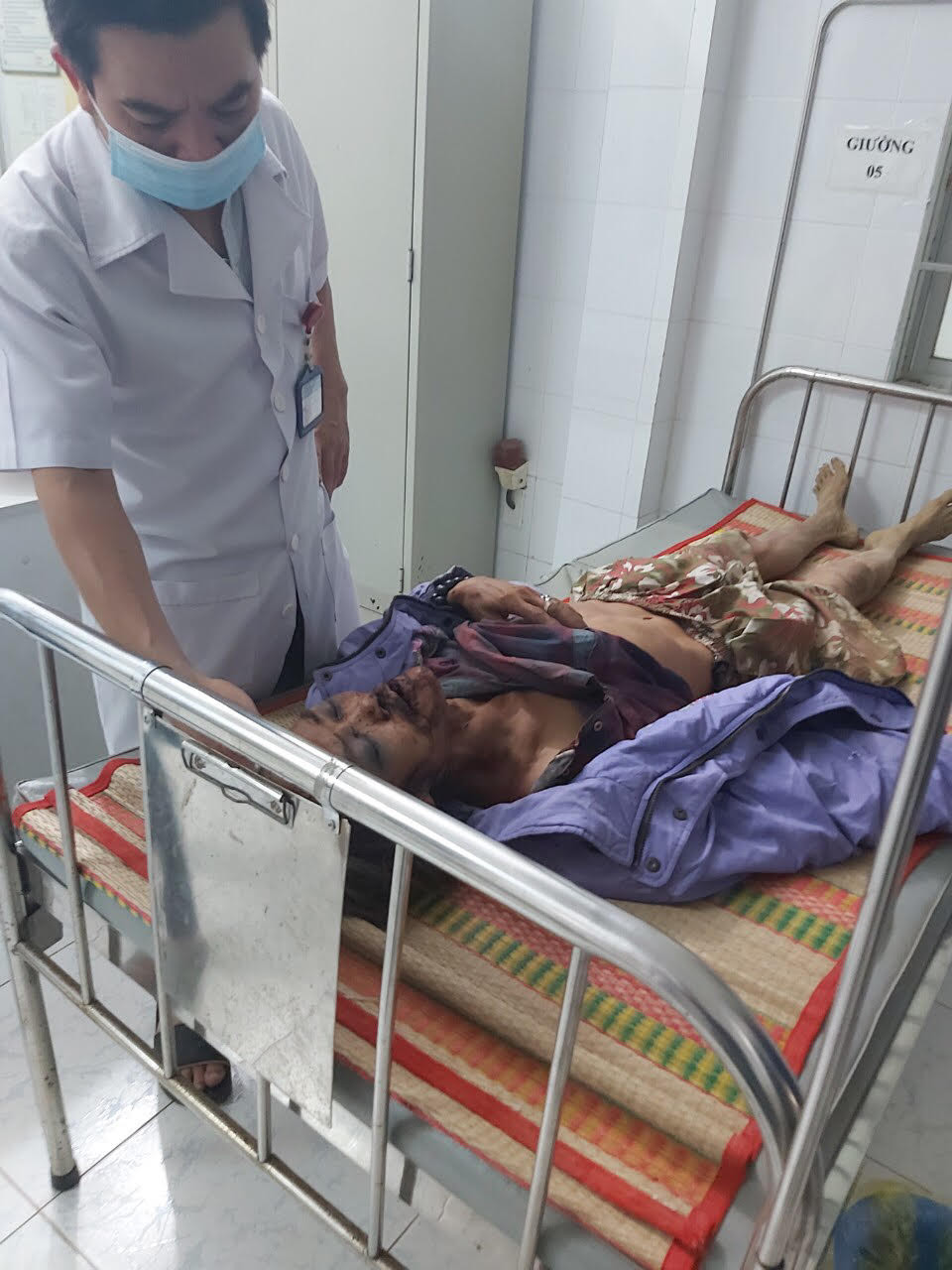 Một người dân nghi bị voi rừng tấn công nguy kịch ảnh 1