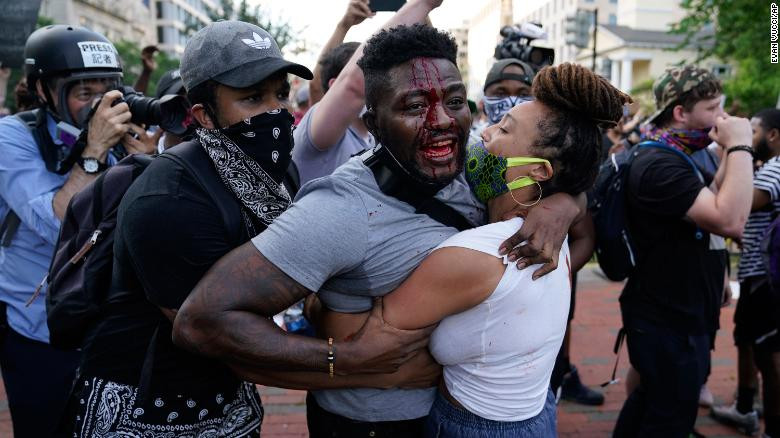 Dữ dội đối đầu cảnh sát và người biểu tình Mỹ ảnh 31