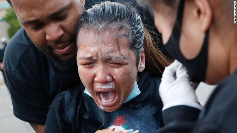 Dữ dội đối đầu cảnh sát và người biểu tình Mỹ ảnh 15