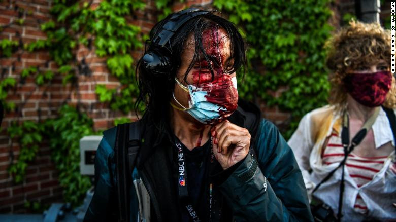 Dữ dội đối đầu cảnh sát và người biểu tình Mỹ ảnh 28