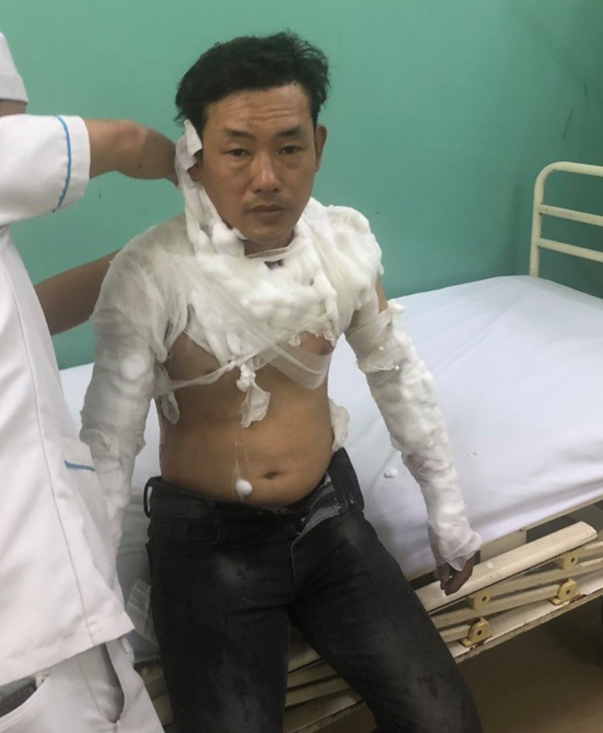 Vụ 9X tẩm xăng lên người để cướp ngân hàng: Nhân viên bí mật nhấn chuông báo động ảnh 1