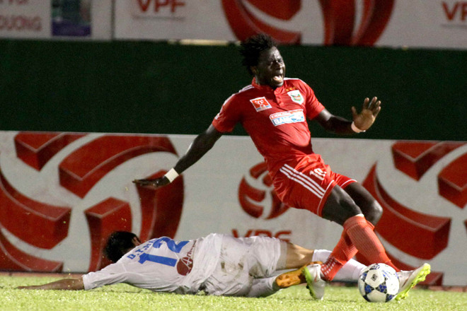 Những ca gãy chân kinh hoàng trong làng bóng đá Việt ảnh 3