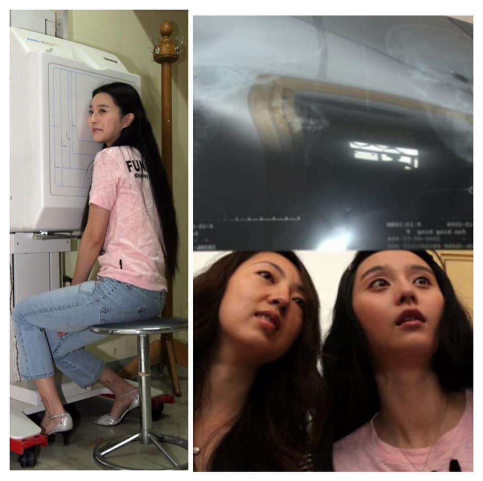 Mỹ nhân xứ Trung và muôn kiểu chứng minh không động 'dao kéo' ảnh 4