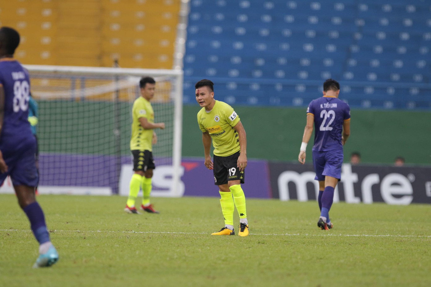 Đá chính trước Bình Dương, Quang Hải đổ máu, băng đầu ảnh 4