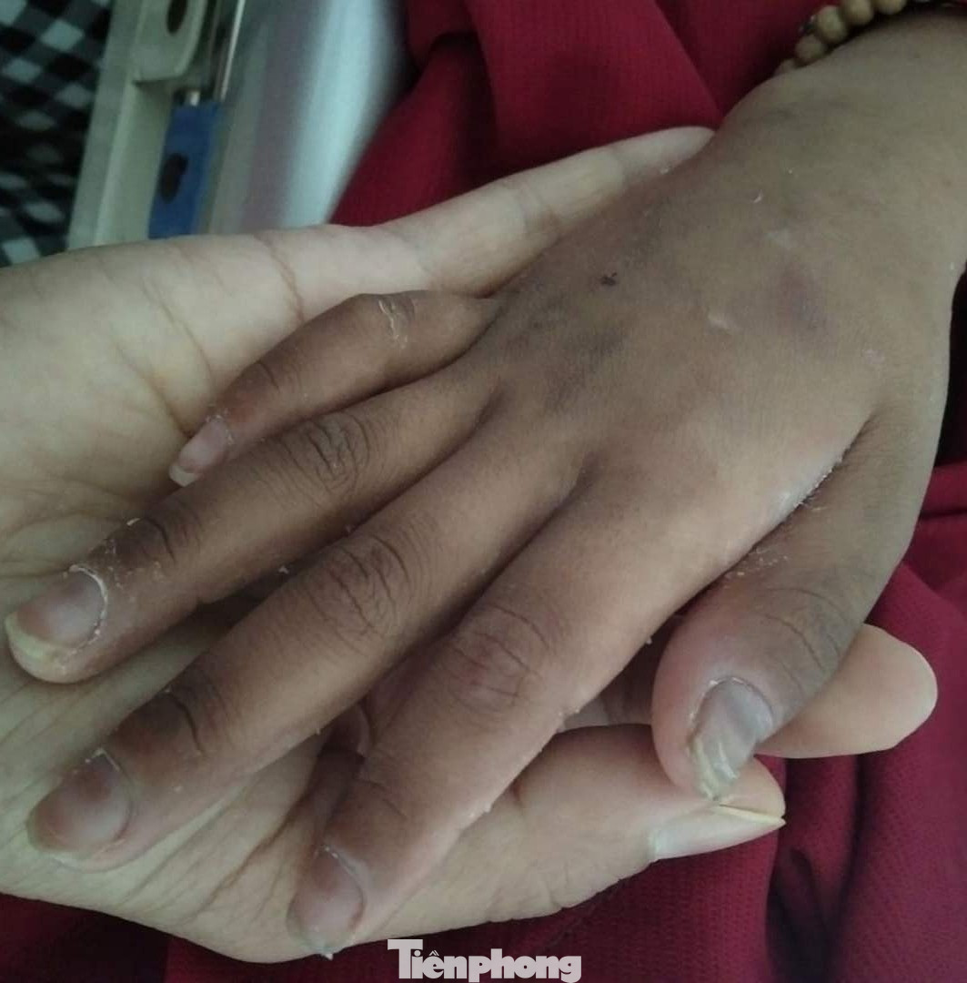 Xót thương bé gái bị ung thư máu cận kề hiểm nguy vì nhà hết tiền ảnh 4