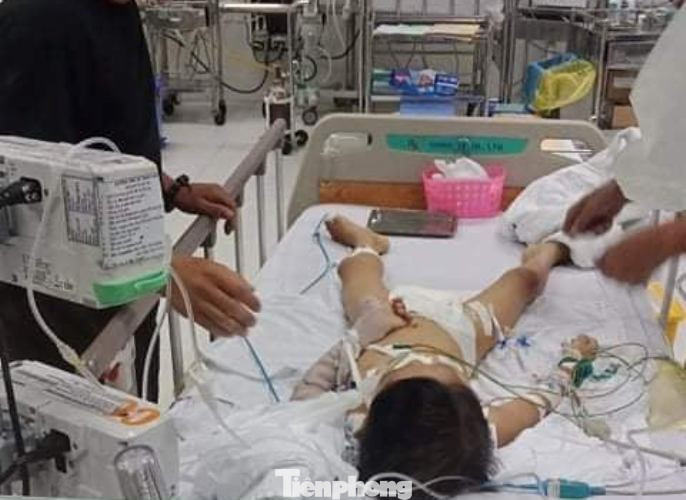 Điều tra làm rõ vụ bé trai tử vong sau mổ tháo đinh nẹp tay ảnh 1