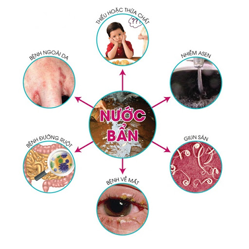 Bộ lọc nước đầu nguồn Tân Á Đại Thành Beluga - giải pháp hoàn hảo cho nguồn nước sinh hoạt ảnh 1