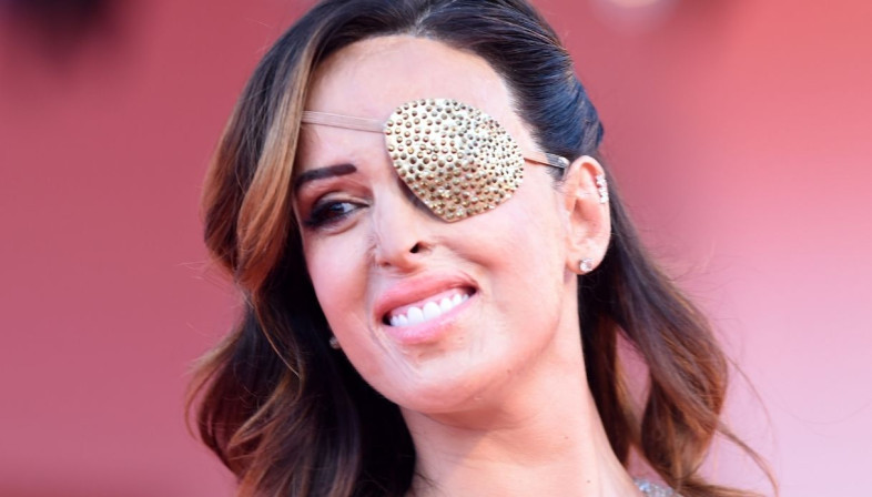 Bi kịch của nữ ca sĩ bịt một mắt lên thảm đỏ LHP Venice ảnh 2