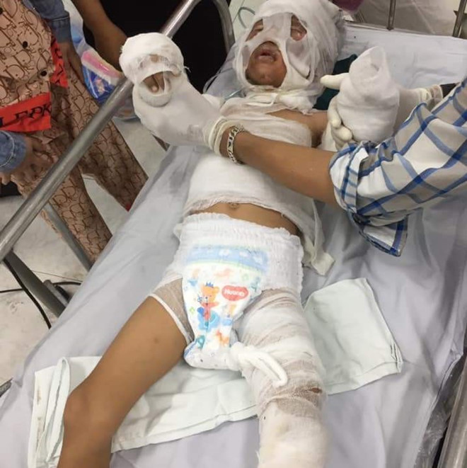 Dì tưới xăng thiêu sống cháu 6 tuổi để đòi nợ? ảnh 2