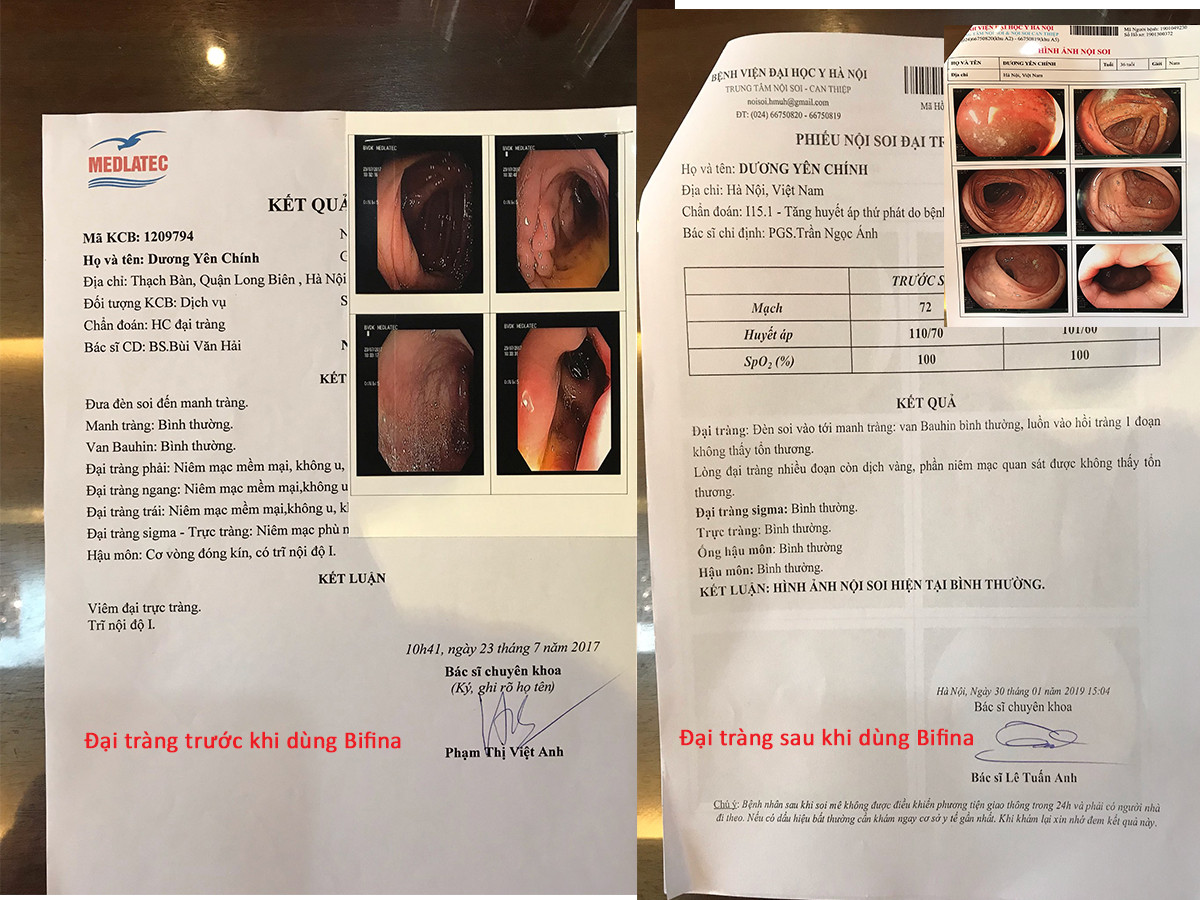 Không còn khổ sở vì viêm đại tràng hành hạ nhờ 'bí quyết' của người Nhật ảnh 1