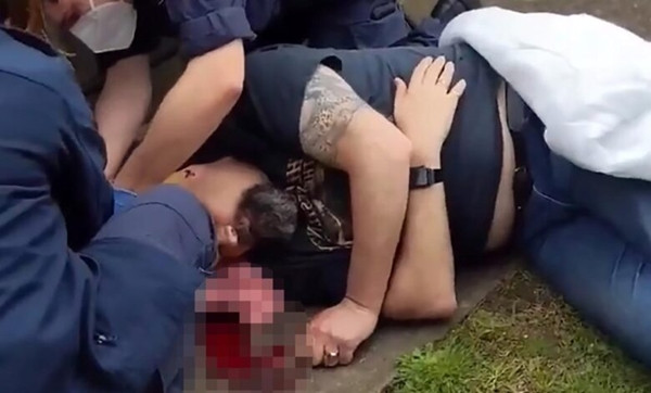 Đeo đồng hồ Apple Watch, chắc không ai nghĩ đến là có ngày nó sẽ cứu mạng mình ảnh 3