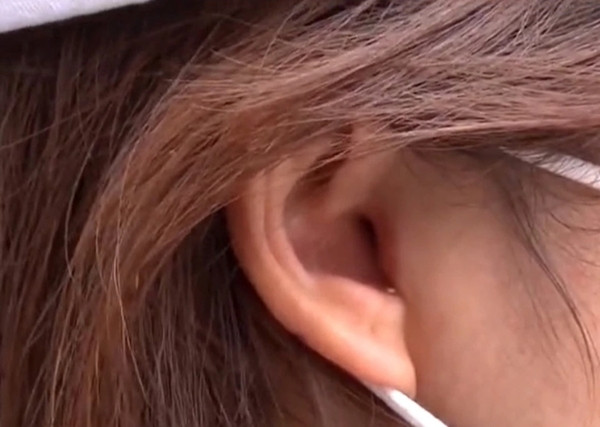 Vào viện thẩm mỹ để sửa mũi, cô gái sốc khi phát hiện ra đã bị cắt mất một phần tai ảnh 3