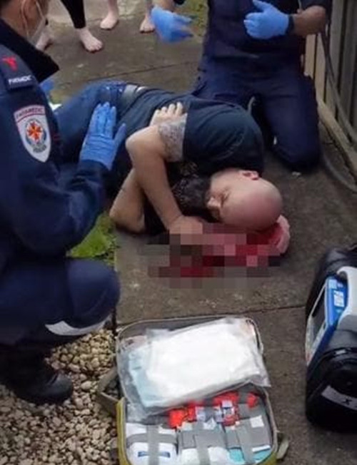 Đeo đồng hồ Apple Watch, chắc không ai nghĩ đến là có ngày nó sẽ cứu mạng mình ảnh 2