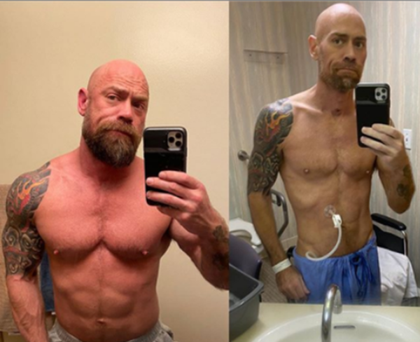 Choáng váng trước sức tàn phá khủng khiếp của COVID-19 đối với cơ thể sau 6 tuần ảnh 1