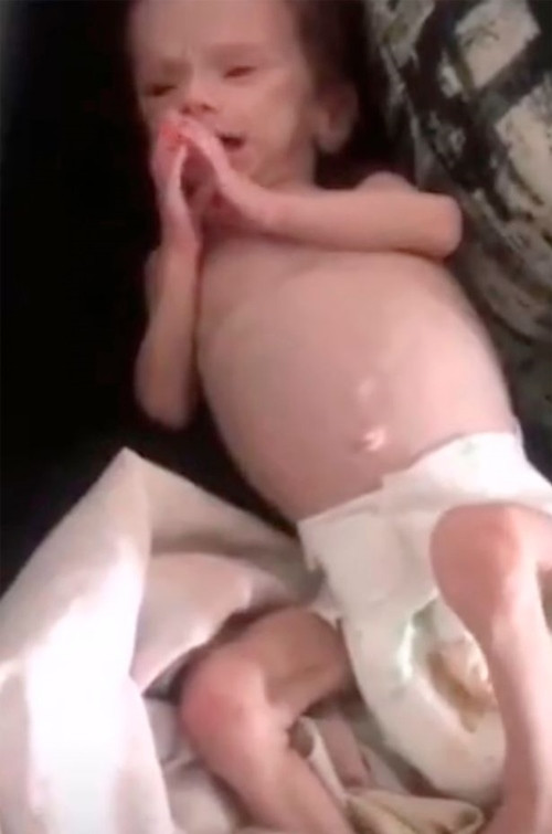 Bé gái sơ sinh bị mẹ bỏ đói trong tủ, sống sót kỳ diệu vì anh trai lén lấy đồ thừa cho ăn ảnh 3