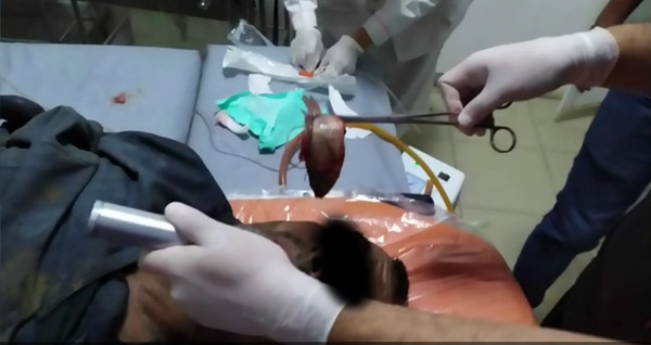 Một người bị con cá sống chui vào cổ họng suýt ngạt thở, lý do thì bạn không tin nổi đâu ảnh 2