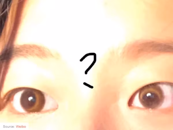 Mua kính áp tròng đang “hot” trên mạng, một loạt khách hàng kêu ca vì kính làm lệch cả mắt ảnh 3