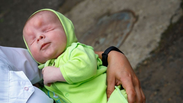 Em bé sinh ra thiếu đi đôi mắt nên bị mẹ bỏ rơi, giờ đã tìm được gia đình yêu thương mình ảnh 3