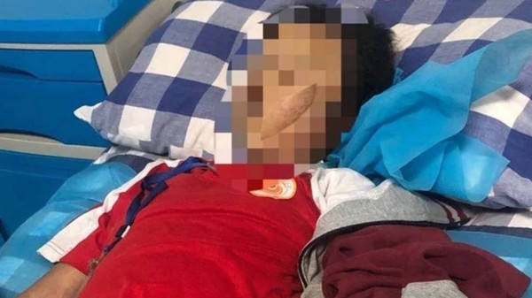 Trả lời sai 2 câu hỏi Toán, học sinh lớp 5 bị giáo viên đánh, vào viện thì không qua khỏi ảnh 2