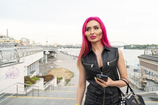 Người ta bơm vòng nọ vòng kia, riêng cô này chỉ bơm má để có “hai gò má to nhất thế giới” ảnh 1