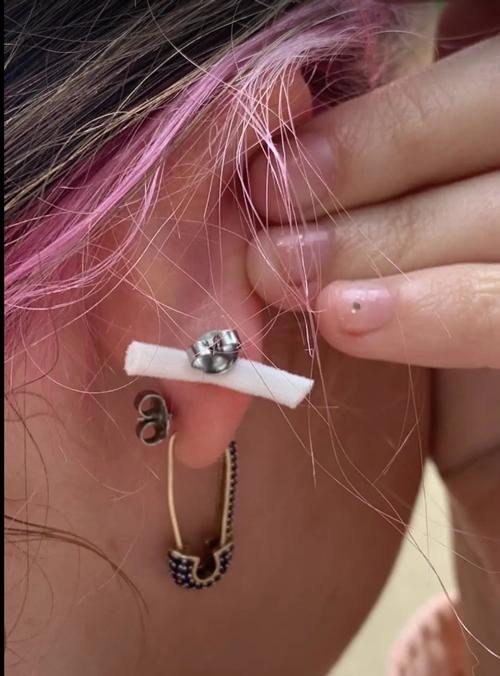 Tai nạn kinh dị của TikToker 16 tuổi: Bị thợ xỏ khuyên bấm luôn quai khẩu trang vào tai ảnh 5