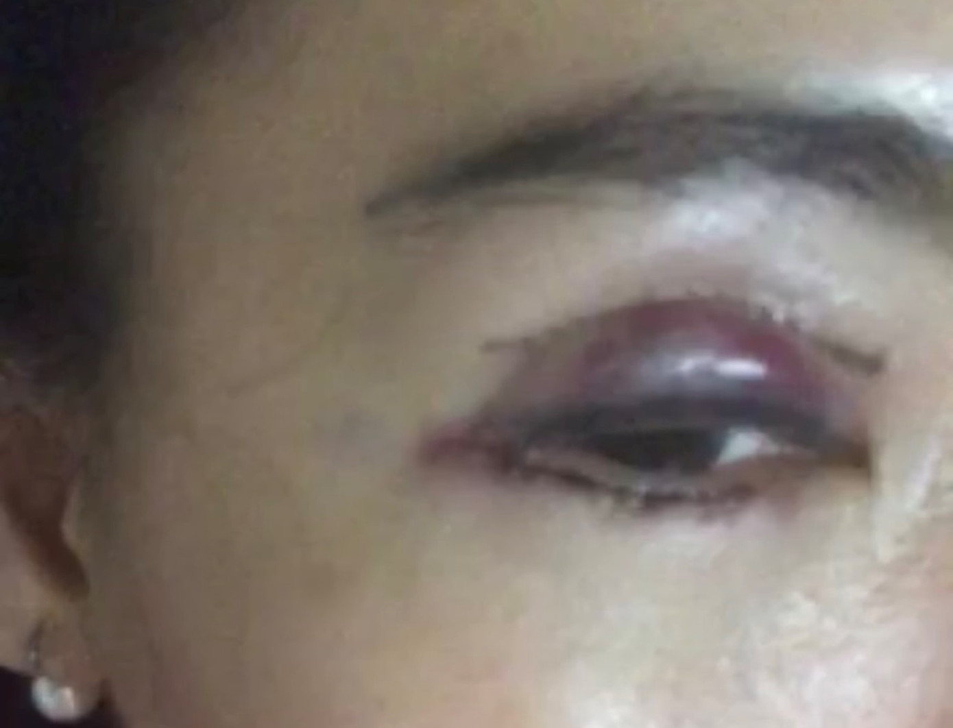 Thẩm mỹ Sophie International bị tố bỏ rơi khách sau khi gây tai biến? ảnh 2