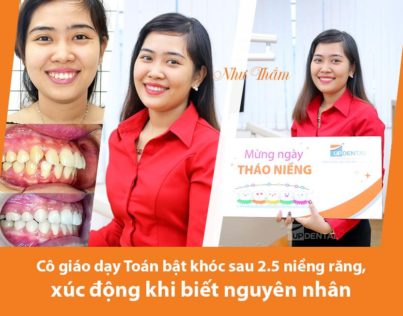 Niềng răng đẹp cỡ nào - câu chuyện niềng răng nhiều cảm xúc của cô giáo Như Thắm ảnh 1
