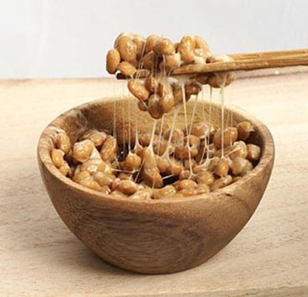 Đột quỵ - Nguyên nhân gây bệnh và cách phòng ngừa hiệu quả ảnh 3