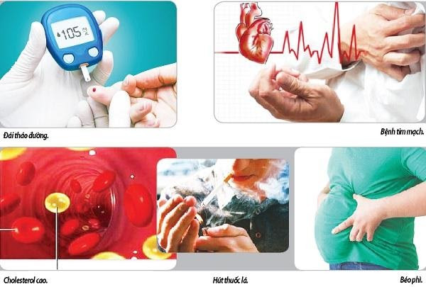 Đột quỵ - Nguyên nhân gây bệnh và cách phòng ngừa hiệu quả ảnh 2