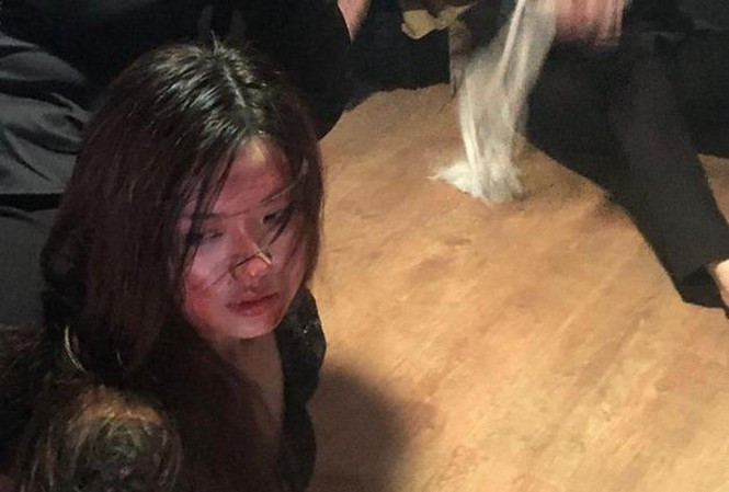 Showbiz 2/11: Siêu mẫu Võ Hoàng Yến nhập viện ảnh 2