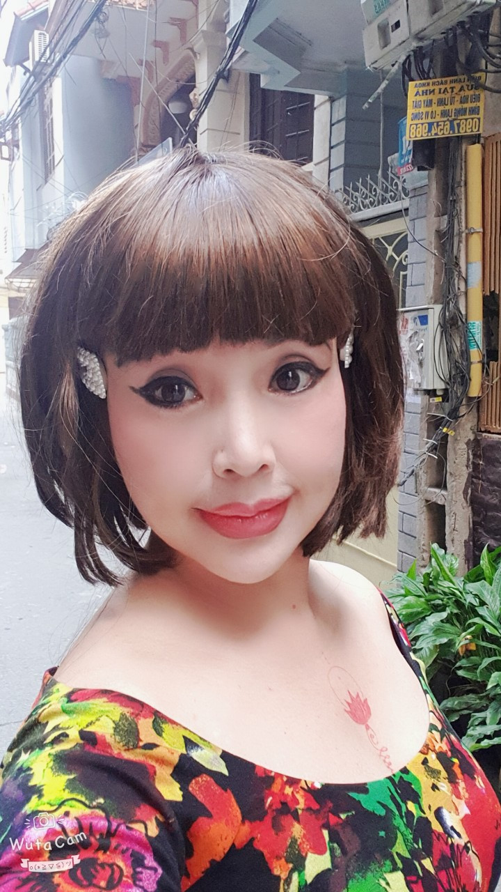 NSND Lan Hương lại gây tranh cãi vì gương mặt cứng đơ khác lạ ảnh 1