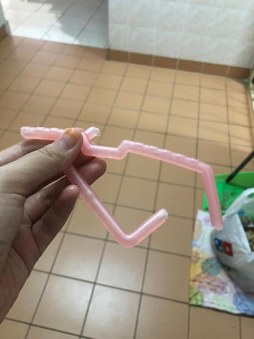 Người mẹ vô ý làm rơi mảnh mắc áo gãy, tai nạn bất ngờ đã xảy ra với cô con gái nhỏ ảnh 1