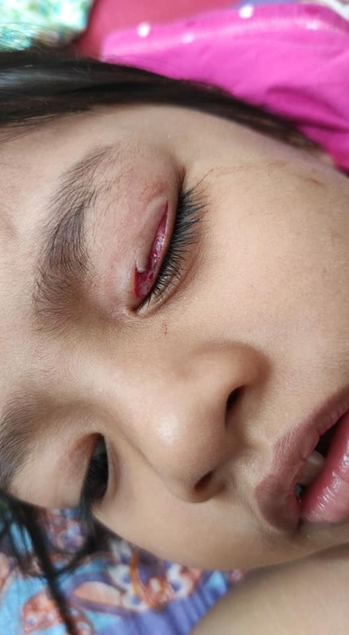 Người mẹ vô ý làm rơi mảnh mắc áo gãy, tai nạn bất ngờ đã xảy ra với cô con gái nhỏ ảnh 2