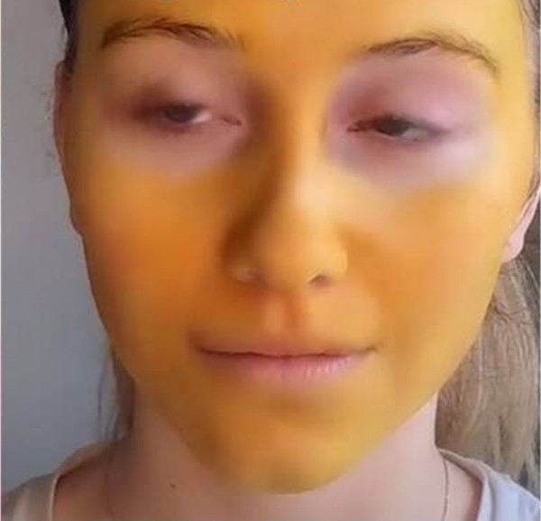 Tự làm kem trộn theo công thức trên mạng, mặt cô gái chuyển màu vàng như Pikachu ảnh 2