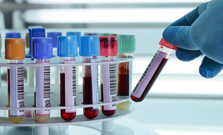 Bệnh viện Bạch Mai thông báo kết quả hơn 14.000 mẫu xét nghiệm SARS-CoV-2 ảnh 3 Bệnh viện Bạch Mai thông báo kết quả hơn 14.000 mẫu xét nghiệm SARS-CoV-2 ảnh 3