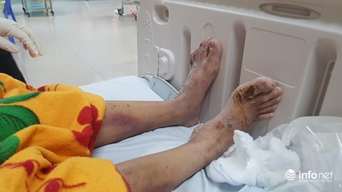 Nữ tiếp viên tố bị chủ ép bán dâm, đánh gãy xương, tra tấn như thời trung cổ ảnh 2