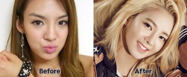 Chỉ thay đổi nhỏ xíu này trên khuôn mặt nhưng lại giúp nhiều idol lên đời nhan sắc ảnh 2