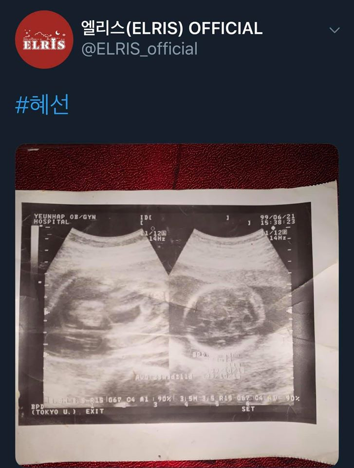 Sao Hàn 24H: Xin quỳ với độ “lầy lội” của sao Hàn trong ngày thiếu nhi Hàn Quốc ảnh 2