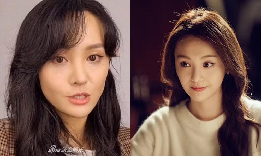 Ai có thể ngờ cô gái với khuôn miệng méo lệch này là “nữ thần thanh xuân” Trịnh Sảng ảnh 4