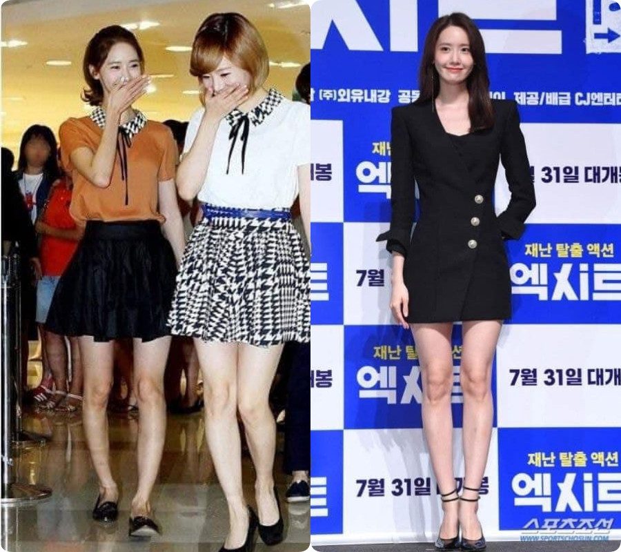 Hô biến chân cong vòng kiềng thành chân thẳng nuột, Yoona để lại “bí ẩn” lớn nhất K-Pop? ảnh 6