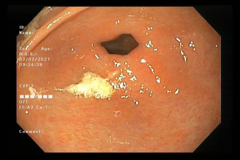 Cha mẹ bàng hoàng khi biết bé gái 9 tuổi bị đau bụng do nguyên nhân từ gia đình ảnh 2