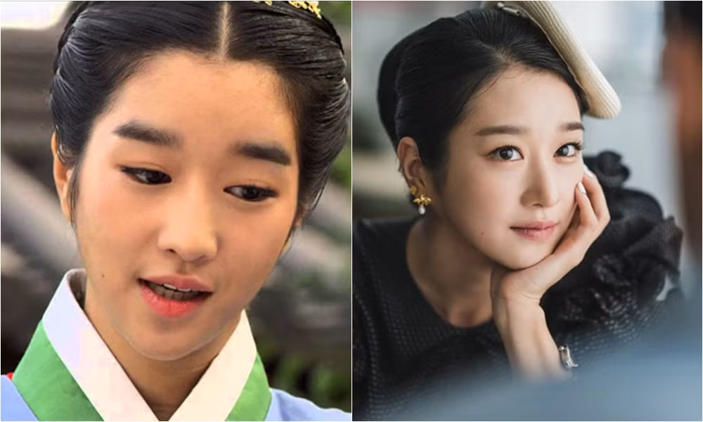 Đây là lý do khiến trước đây Seo Ye Ji “Điên Thì Có Sao” chưa thể lên đời nhan sắc ảnh 6