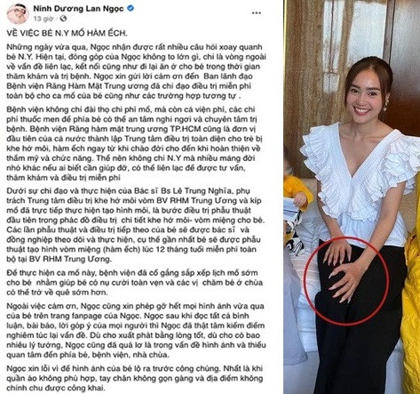 Lan Ngọc đã lên tiếng xin lỗi vì trang phục và móng tay chưa phù hợp khi đi làm từ thiện Bị chỉ trích vì bộ móng tay quá điệu đà, Lan Ngọc xử lý không chê vào đâu được ảnh 3