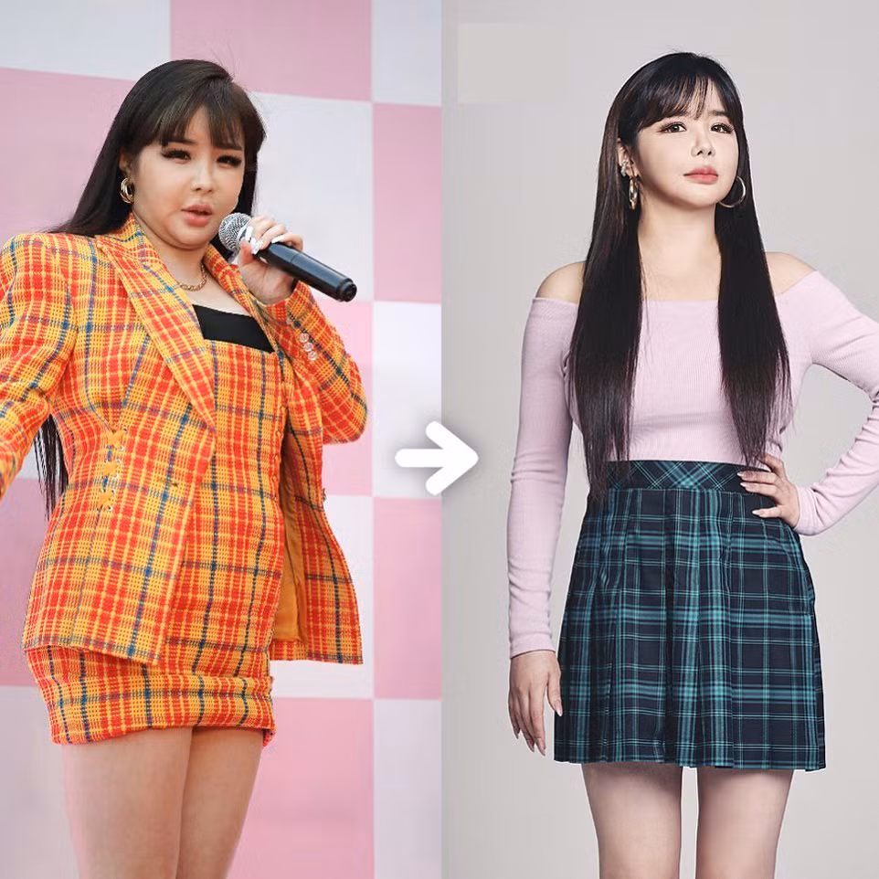 Khoe ảnh giảm tới 11 kg, Park Bom nhanh chóng trở thành “động lực năm mới” của các cô gái ảnh 1