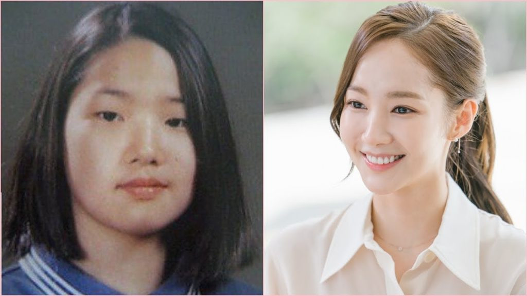 Nhiều người vẫn cho rằng cô gái bên trái chính là Park Min Young thời chưa phẫu thuật Sự thật gây sốc về bức ảnh của “Nữ hoàng dao kéo” Park Min Young trước khi thẩm mỹ ảnh 2