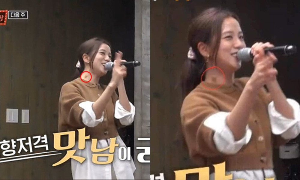 Jisoo (BLACKPINK) nổi hạch lớn ở cổ, bệnh cũ tái phát do phải làm việc đến kiệt sức? ảnh 1