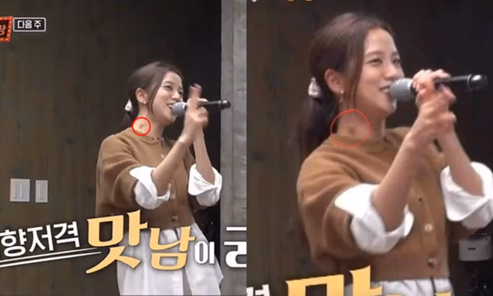 Jisoo (BLACKPINK) nổi hạch lớn ở cổ, bệnh cũ tái phát do phải làm việc đến kiệt sức? ảnh 1