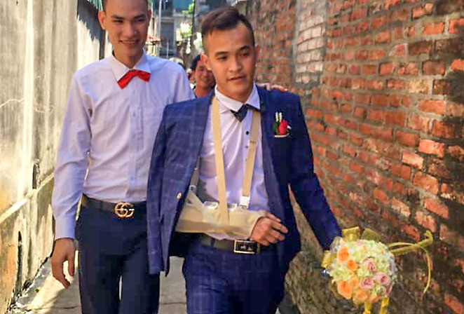 Chú rể Hà Nội ngã gãy tay vì bạn bè tung hứng ảnh 2
